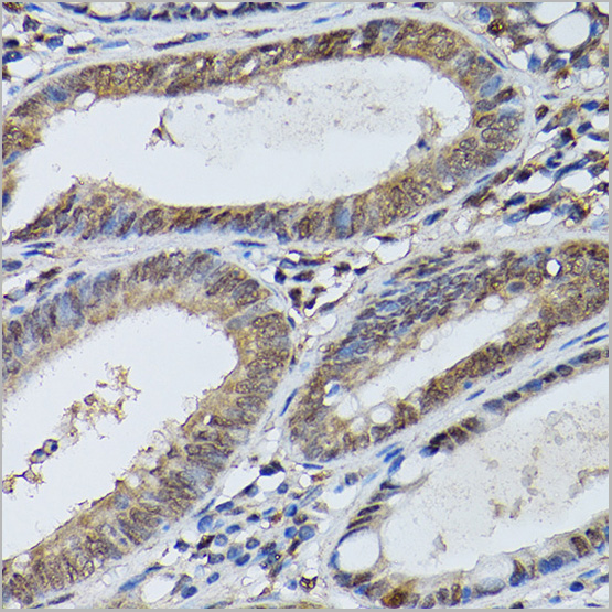 product-image-AAA28416_IHC3.jpg