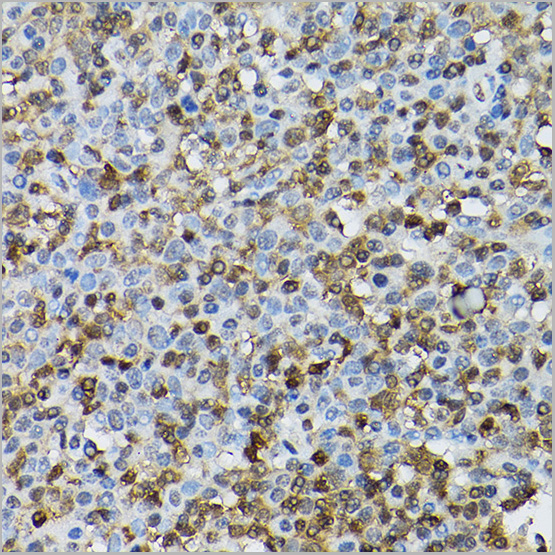 product-image-AAA28416_IHC4.jpg