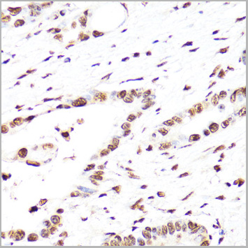 product-image-AAA28417_IHC3.jpg
