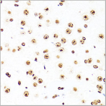 product-image-AAA28417_IHC4.jpg