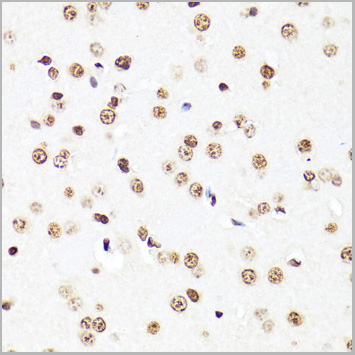 product-image-AAA28417_IHC5.jpg