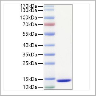 product-image-AAA28445_SDS_PAGE.jpg