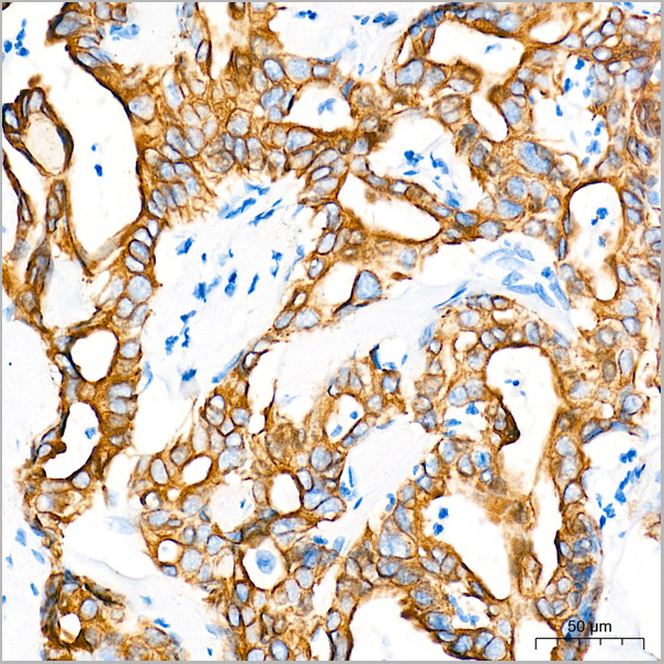 product-image-AAA28447_IHC6.jpg