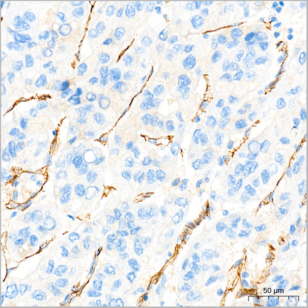 product-image-AAA28448_IHC4.jpg