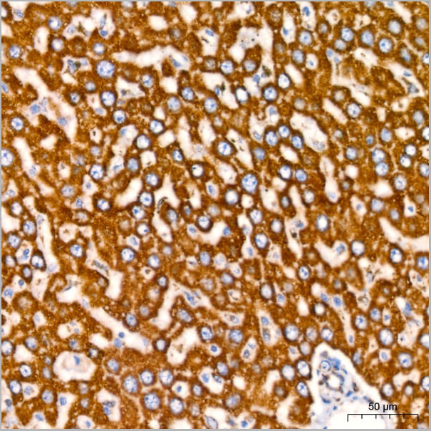 product-image-AAA28451_IHC11.jpg