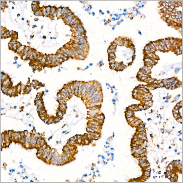 product-image-AAA28451_IHC6.jpg