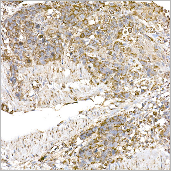 product-image-AAA28455_IHC3.jpg
