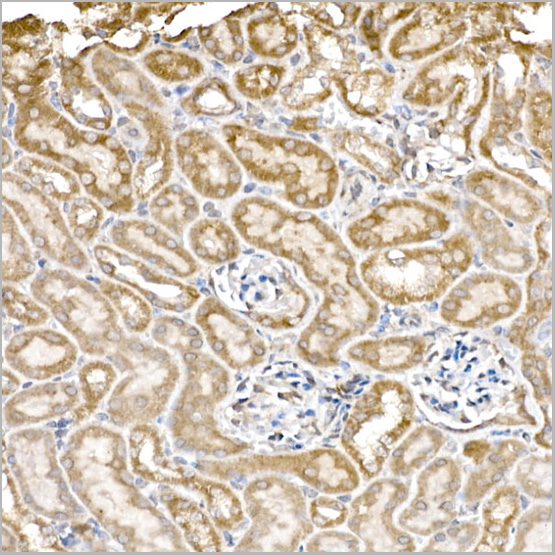 product-image-AAA28455_IHC5.jpg