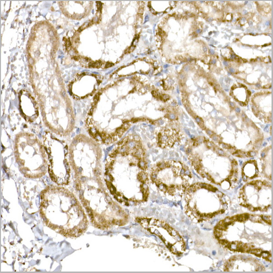 product-image-AAA28455_IHC6.jpg