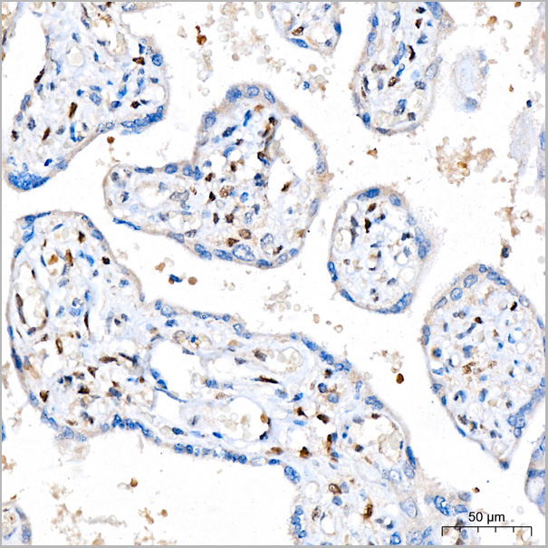 product-image-AAA28460_IHC5.jpg