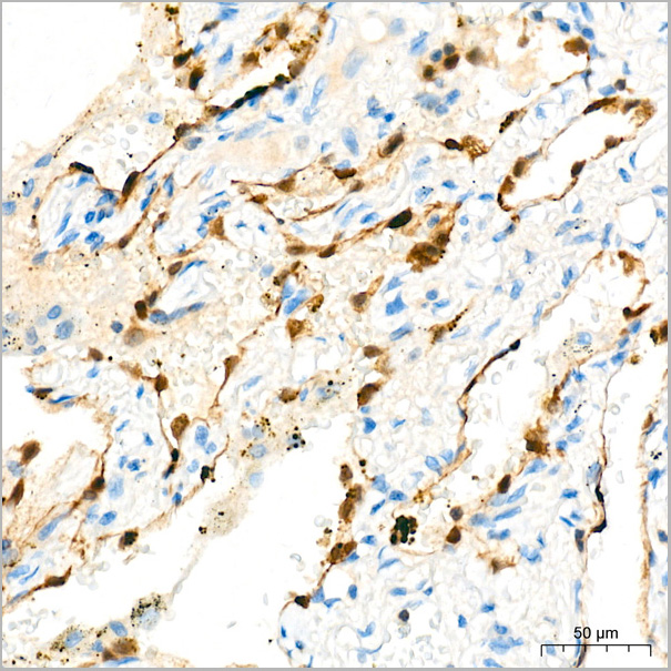 product-image-AAA28463_IHC3.jpg