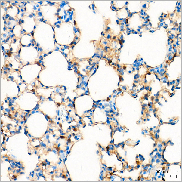 product-image-AAA28463_IHC6.jpg