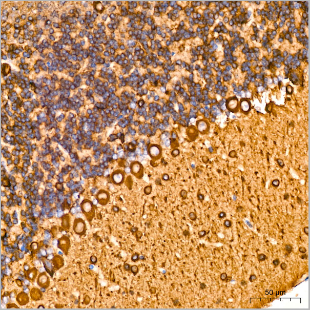 product-image-AAA28465_IHC3.jpg