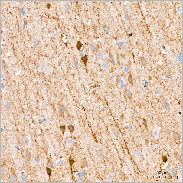 product-image-AAA28474_IHC2.jpg