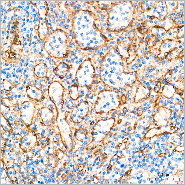 product-image-AAA28480_IHC2.jpg