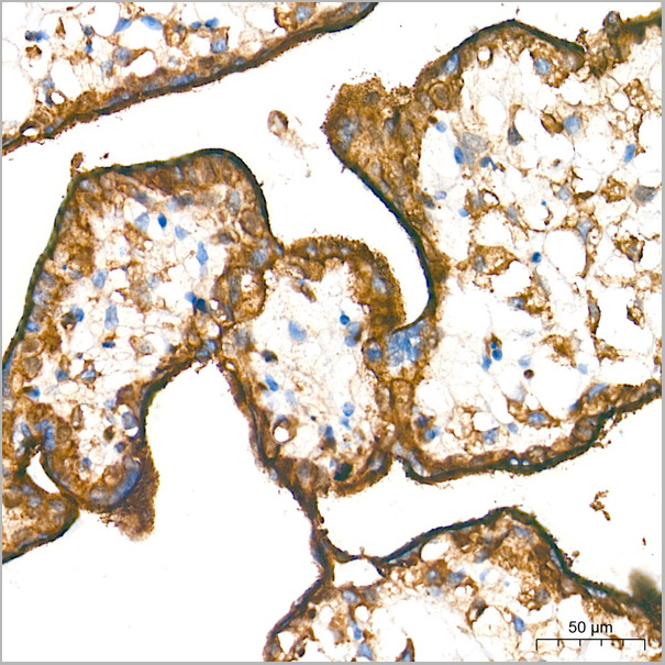 product-image-AAA28480_IHC3.jpg