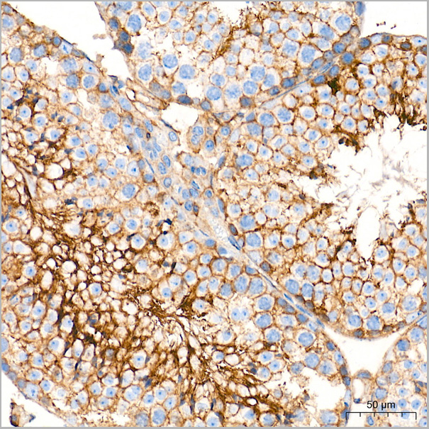 product-image-AAA28480_IHC6.jpg