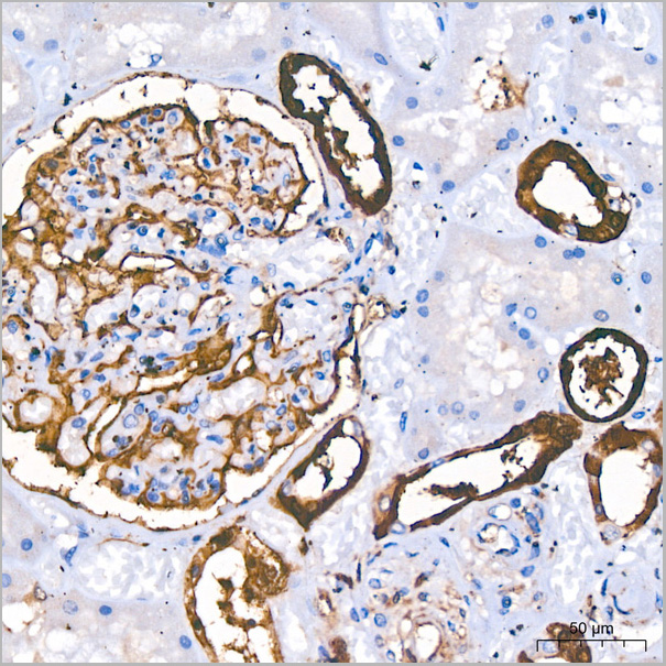 product-image-AAA28485_IHC2.jpg