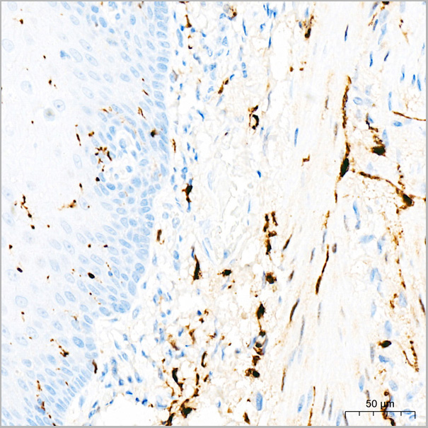 product-image-AAA28487_IHC3.jpg