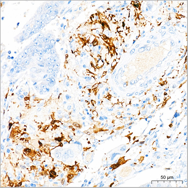 product-image-AAA28487_IHC4.jpg