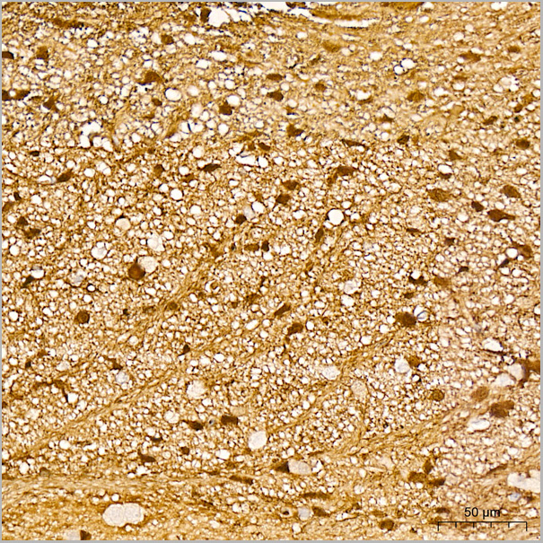 product-image-AAA28487_IHC5.jpg