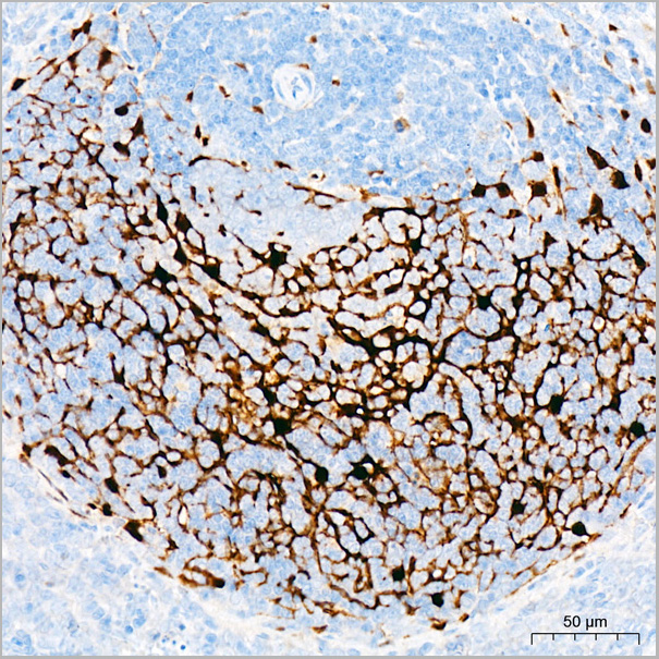 product-image-AAA28487_IHC6.jpg