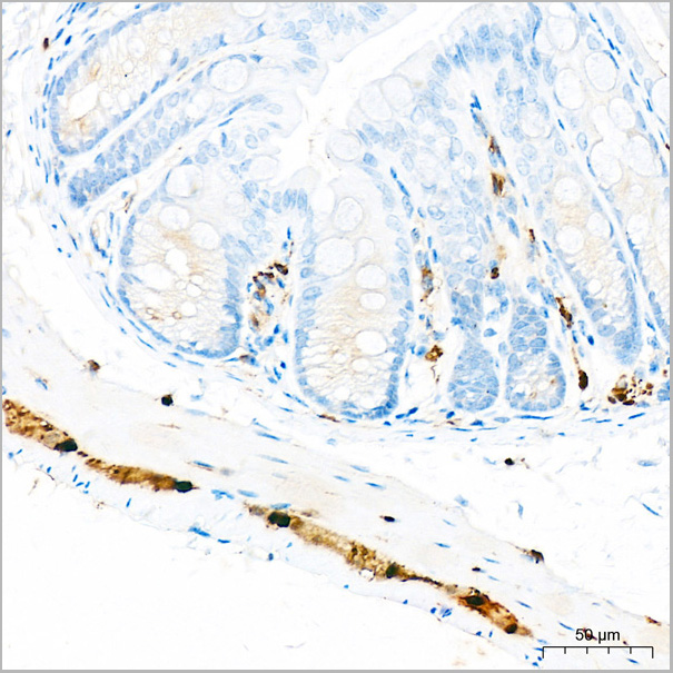 product-image-AAA28487_IHC9.jpg