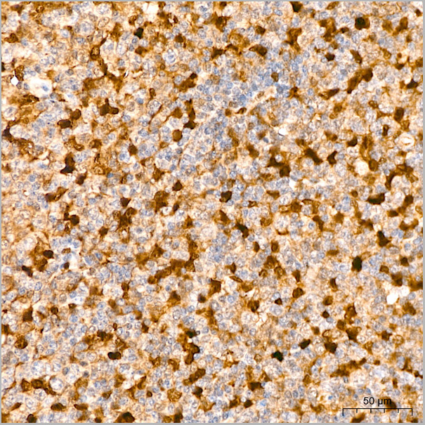 product-image-AAA28488_IHC6.jpg