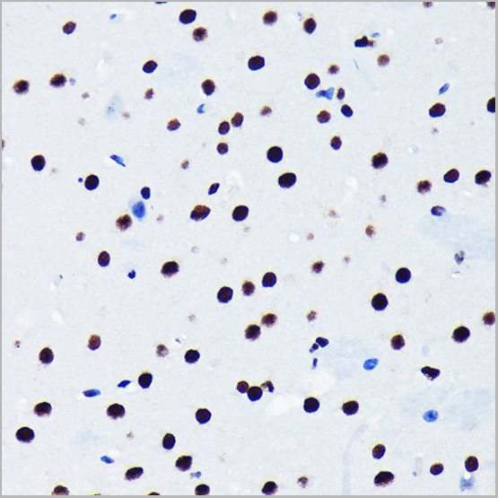 product-image-AAA28493_IHC2.jpg