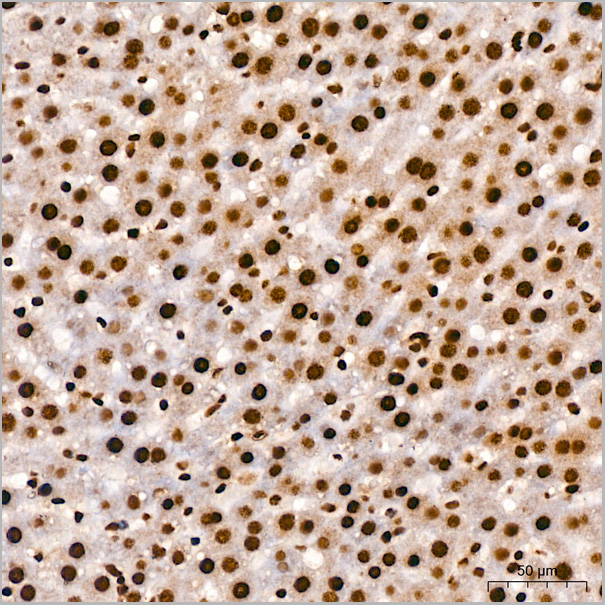 product-image-AAA28493_IHC6.jpg