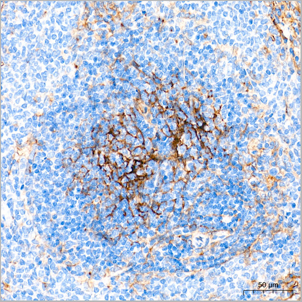 product-image-AAA28494_IHC2.jpg