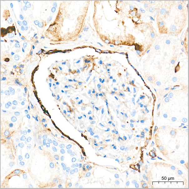 product-image-AAA28494_IHC3.jpg