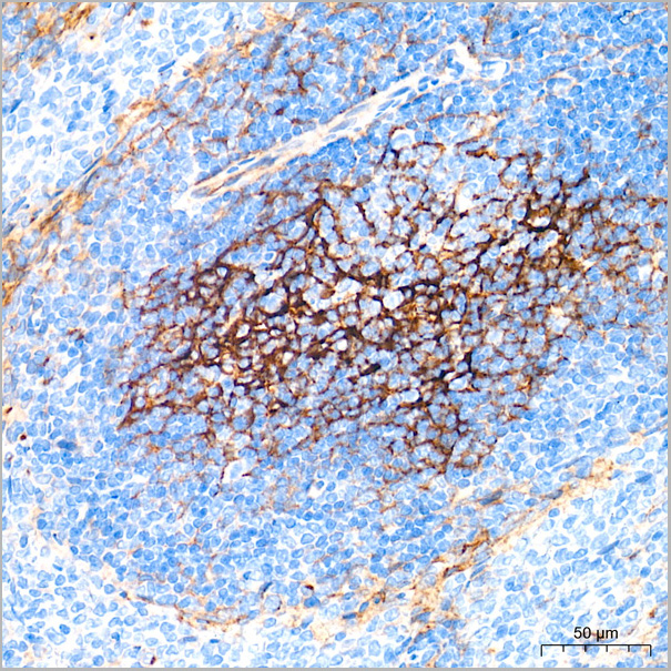 product-image-AAA28494_IHC4.jpg