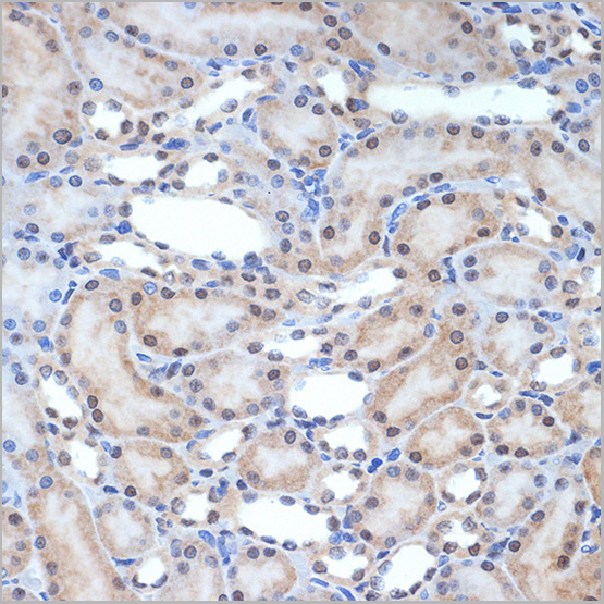 product-image-AAA28497_IHC2.jpg