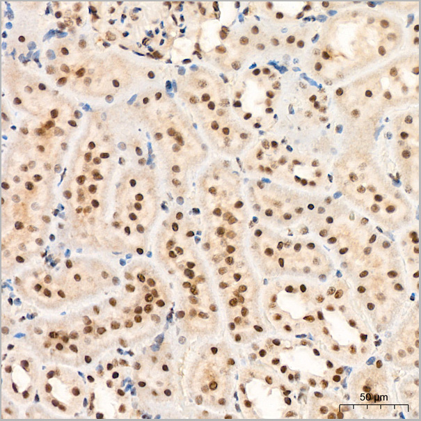 product-image-AAA28497_IHC5.jpg