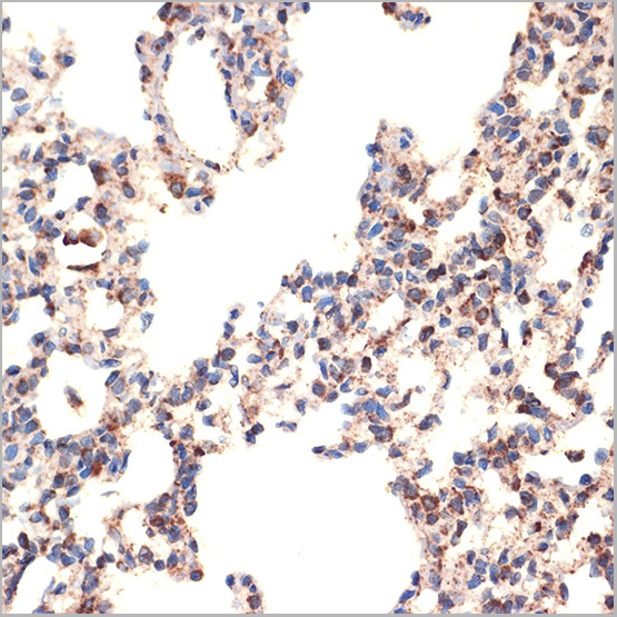 product-image-AAA28501_IHC3.jpg