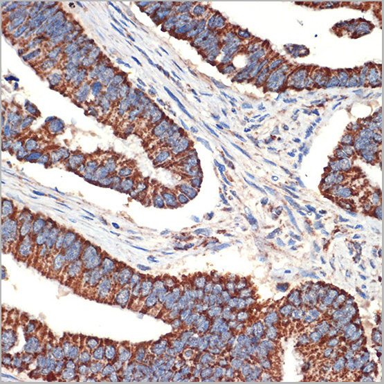 product-image-AAA28501_IHC4.jpg