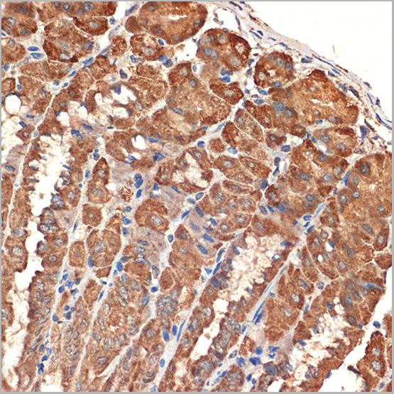 product-image-AAA28501_IHC5.jpg