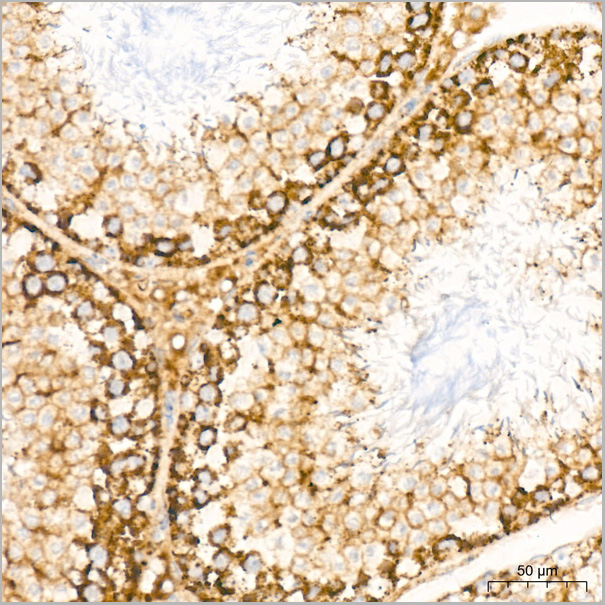product-image-AAA28501_IHC6.jpg