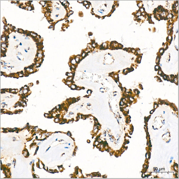 product-image-AAA28501_IHC7.jpg