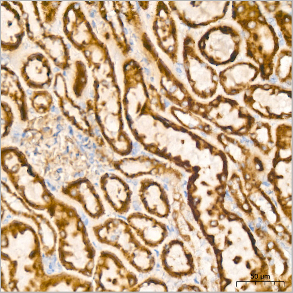 product-image-AAA28501_IHC8.jpg