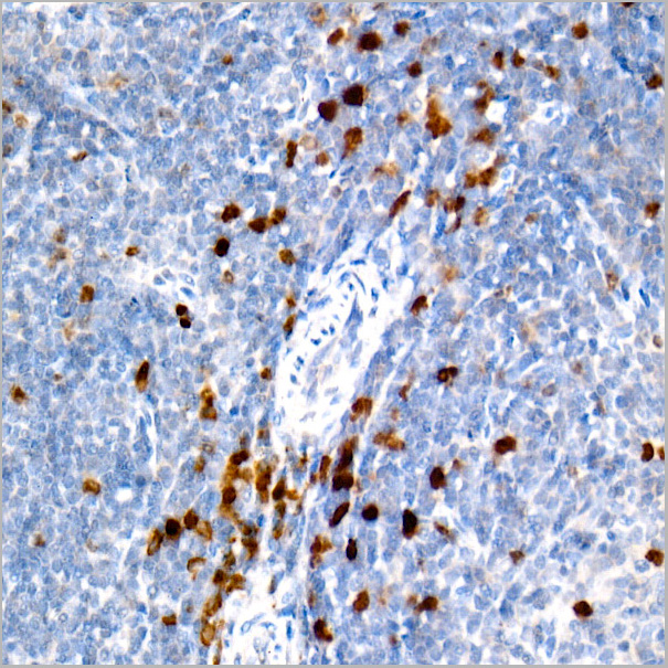 product-image-AAA28505_IHC2.jpg