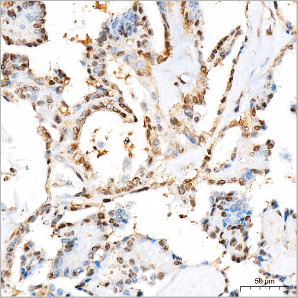 product-image-AAA28509_IHC6.jpg