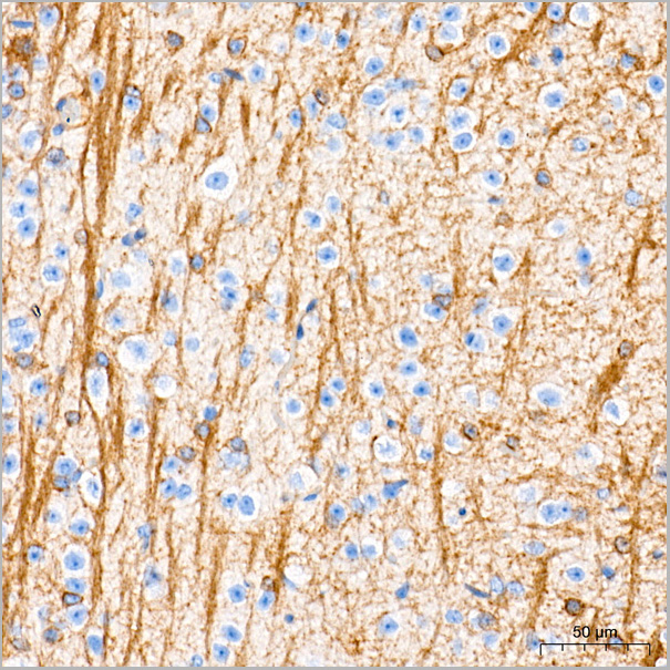 product-image-AAA28518_IHC4.jpg