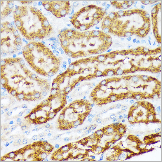 product-image-AAA28519_IHC4.jpg