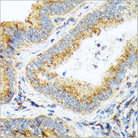 product-image-AAA28522_IHC3.jpg