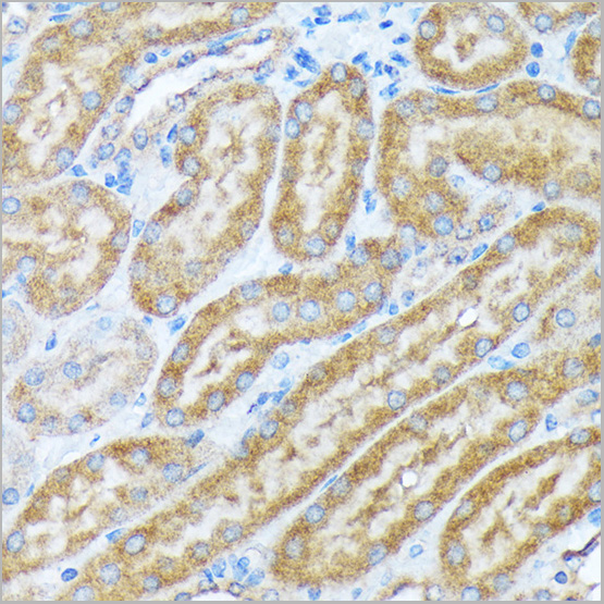 product-image-AAA28522_IHC4.jpg