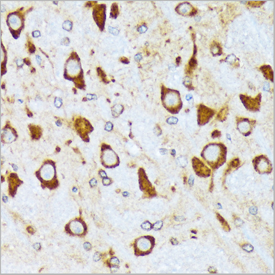 product-image-AAA28522_IHC5.jpg