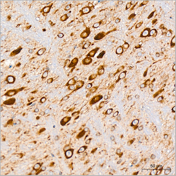product-image-AAA28522_IHC8.jpg