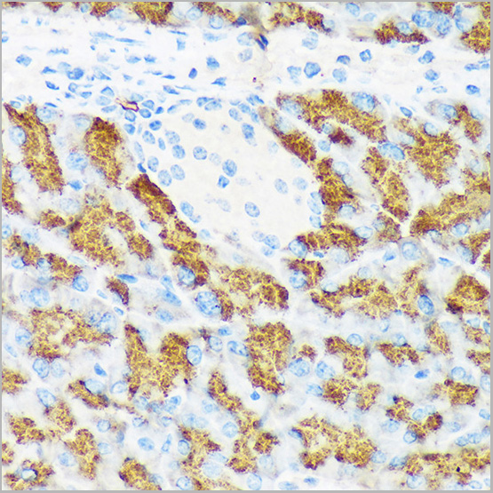 product-image-AAA28523_IHC2.jpg